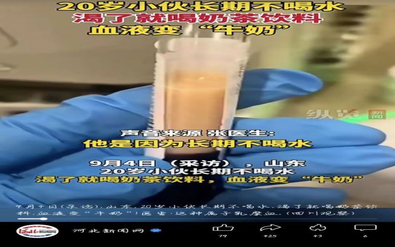 20岁男子血液呈乳白色，长期以奶茶饮料代替白水引发健康警示
