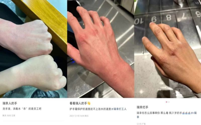瑞幸咖啡师冬季手部皲裂现象调查：频繁洗手规范下的职业代价